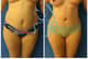 Slider image (9) Dr. Xavier Toscano - Plastic Surgeon